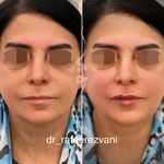 مرکز تخصصی لیزر و زیبایی و لاغری پیور