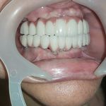 مطب ایمپلنت دکتر نیما شفیعی