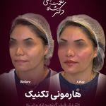مرکز تخصصی پوست، مو،لیزر باران