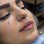 کیلینیک زیبایی ملورا