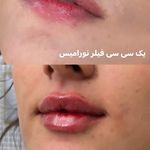 پیرسینگ گلد