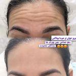 کلینیک پوست،مو،زیبایی،مرکز لیزر ‌پرنسا