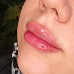 مرکز لیزر ونوس طلایی
