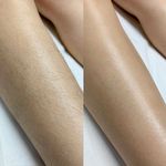 کلینیک پوست و مو و لیزر آتن