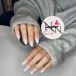 مرکز کاشت ناخن نیلی