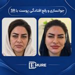 مرکز تخصصی زیبایی و جوانسازی دمور