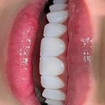 کلینیک دندانپزشکی خاورمیانه نقد و اقساط