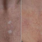 خدمات تخصصی تتو و کاموفلاژ بانوان- تارا