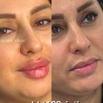 کلینیک زیبایی و لیزر هیرا