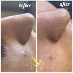 خدمات تخصصی فیشال نیلو