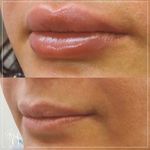 کلینیک پوست و مو و لیزر نیلوفر آبی