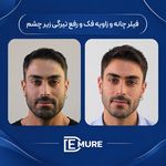 مرکز تخصصی زیبایی و جوانسازی دمور
