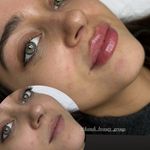 مرکز لیزر ،پوست و زیبایی کندی بیوتی