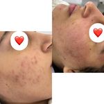 مرکز تخصصی پوست طاحانی