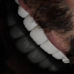 کلینیک تخصصی دندانپزشکی آلفا(بیمه داریم)