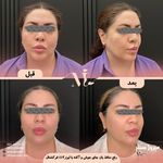 مرکز پزشکی و زیبایی میروژ سنتر