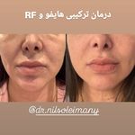 دکتر نیلوفر سلیمانی پوست و مو و زیبایی