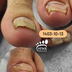 پودولوژی هیوا