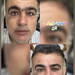 خدمات زیبایی دکتر بهمن صفدری