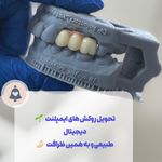 مرکز دندانپزشکی و ایمپلنت شادی