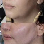 کلینیک زیبایی الماس کاملا اقساطی