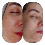 خدمات و آموزش پاکسازی پوست سالن ملورین