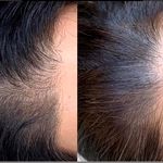 مرکز زیبایی بوتاکس و ژل و لیزر نایس