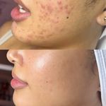 پاکسازی پوست و مو مهسام
