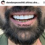 دکتر حسین اکبری دندانپزشک (زیبایی )
