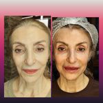 مطب پوست ،مو و لیزر یسنا طب