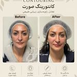 مرکز لیزر ،پوست و زیبایی کندی بیوتی