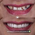 مطب دکترفاطمه متین فرددندانپزشکی زیبایی