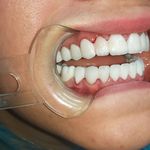 مطب ایمپلنت دکتر نیما شفیعی
