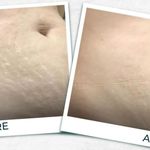 پاکسازی و آبرسانی صورت(فیشال)