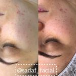 پاکسازی پوست صدف