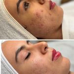 خدمات تخصصی فیشال گلنازفرجی