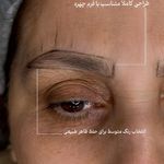 مرکز زیبایی عاطفه ترابی؛ فیبروز ابرو در اصفهان