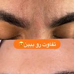 فیشیال و پاکسازی تخصصی ندا دمیرچی
