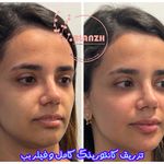 کلینیک پوست و مو بلانژ