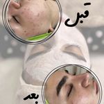 سالن زیبایی اکستنشن شرق