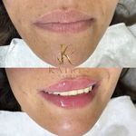 کلینیک زیبایی کاترین