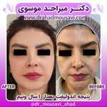 دکترمیراحدموسوی