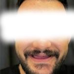 دندانسازی احمدزاده