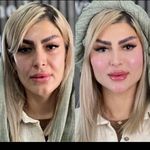 مرکز پوست و لیزر  سایناشور آمریکا دلدار