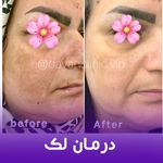 کلینیک لیزر و زیبایی دایان