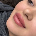 ریموو شیدینگ میکروبلیدینگ