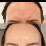 کلینیک ژل بوتاکس لیزر فیل بیوتی