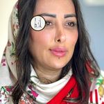 کلینیک زیبایی و لیزر هیرا