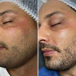 کلینیک فیشال و ماساژ سارن اسکین سارا