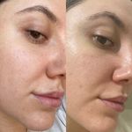 کلینیک پاکسازی پوست و فیشال ژیوان